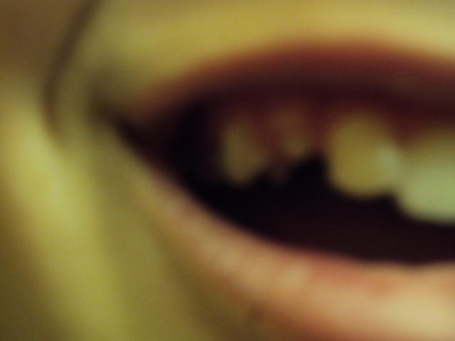 DSC00852