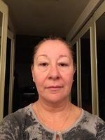 1-IMG 0630